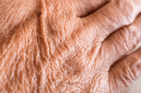 aging hands